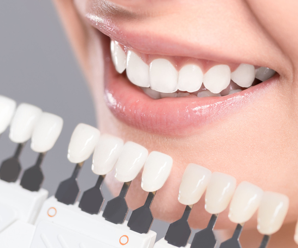 Die Zahnästhetik ist einer der Behandlungsschwerpunkte von Zahnarzt Dr. Adrian Hurrle in Freiburg.